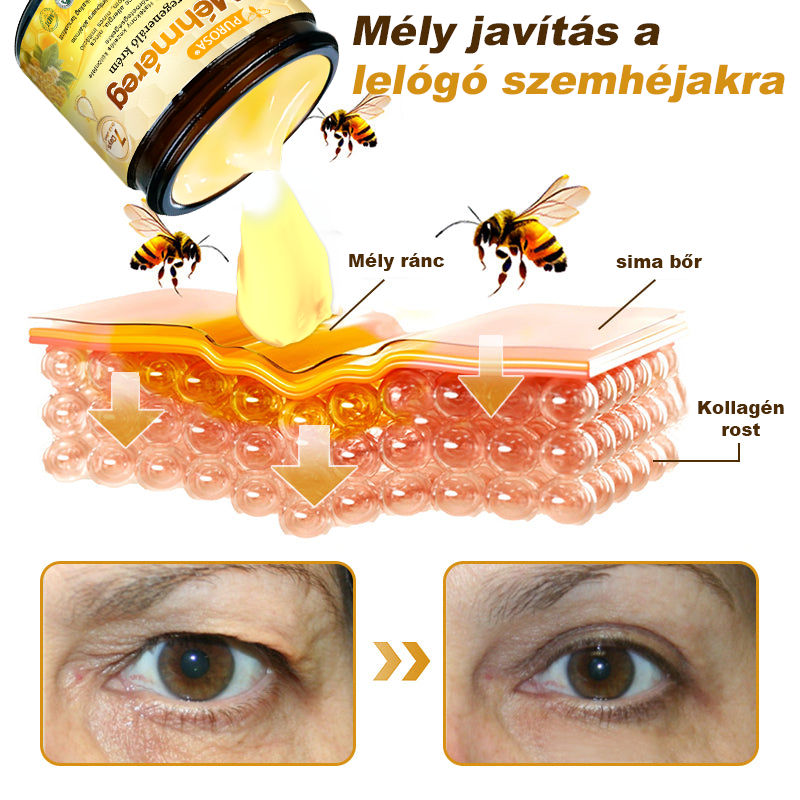 🐝PUROSA® Méhméreg Bőrmegújító Krém|✅Teljes körű megoldás a makacs bőrproblémák, például az öregedés, ekcéma, hegek és pikkelysömör ellen
