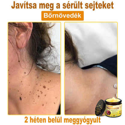 🐝PUROSA® Méhméreg Bőrmegújító Krém｜✅Teljes körű megoldás a makacs bőrproblémák, például az öregedés, ekcéma, hegek és pikkelysömör ellen