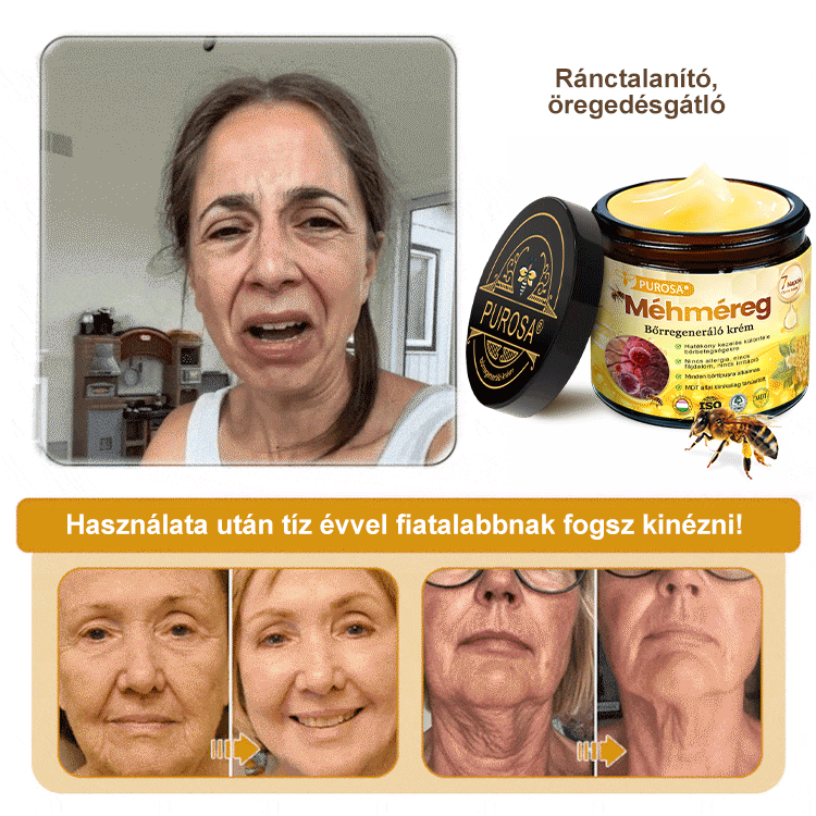 🐝PUROSA® Méhméreg Bőrmegújító Krém｜✅Teljes körű megoldás a makacs bőrproblémák, például az öregedés, ekcéma, hegek és pikkelysömör ellen