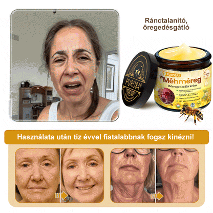 🐝PUROSA® Méhméreg Bőrmegújító Krém｜✅Teljes körű megoldás a makacs bőrproblémák, például az öregedés, ekcéma, hegek és pikkelysömör ellen