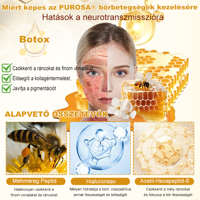 🐝PUROSA® Méhméreg Bőrmegújító Krém｜✅Teljes körű megoldás a makacs bőrproblémák, például az öregedés, ekcéma, hegek és pikkelysömör ellen
