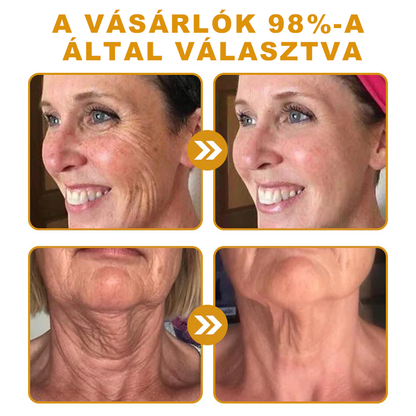 🐝PUROSA® Méhméreg Bőrmegújító Krém｜✅Teljes körű megoldás a makacs bőrproblémák, például az öregedés, ekcéma, hegek és pikkelysömör ellen